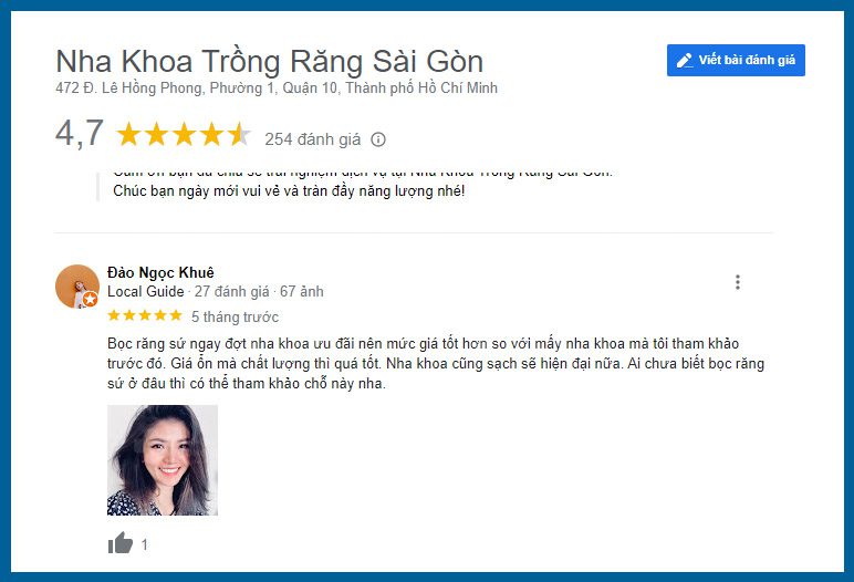 review bọc răng sứ
