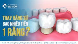 thay răng sứ bao nhiêu tiền