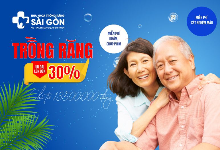 ưu đãi trồng răng
