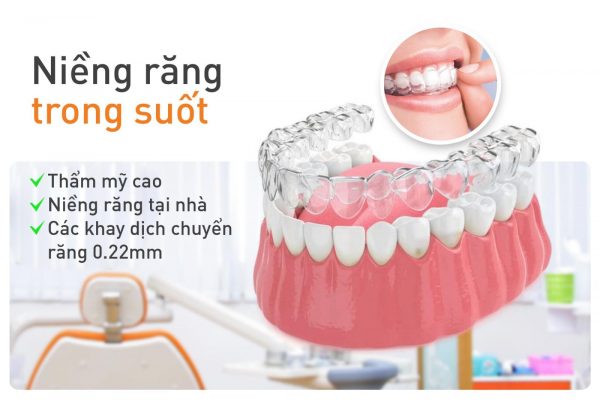 Niềng Invisalign và tất cả những gì bạn cần biết