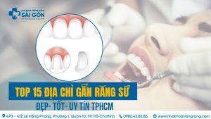 địa chỉ gắn răng sứ uy tín