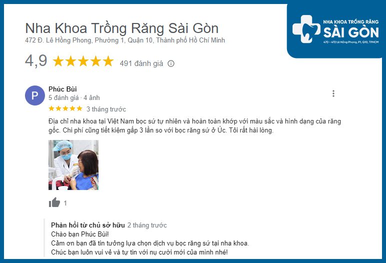 review nha khoa bọc răng sứ