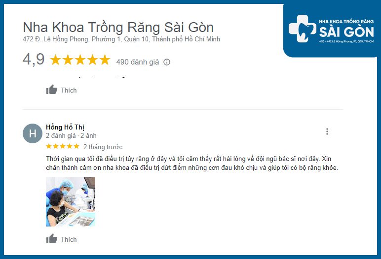 review nha khoa chữa tủy răng