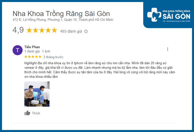 review nha khoa dán răng sứ