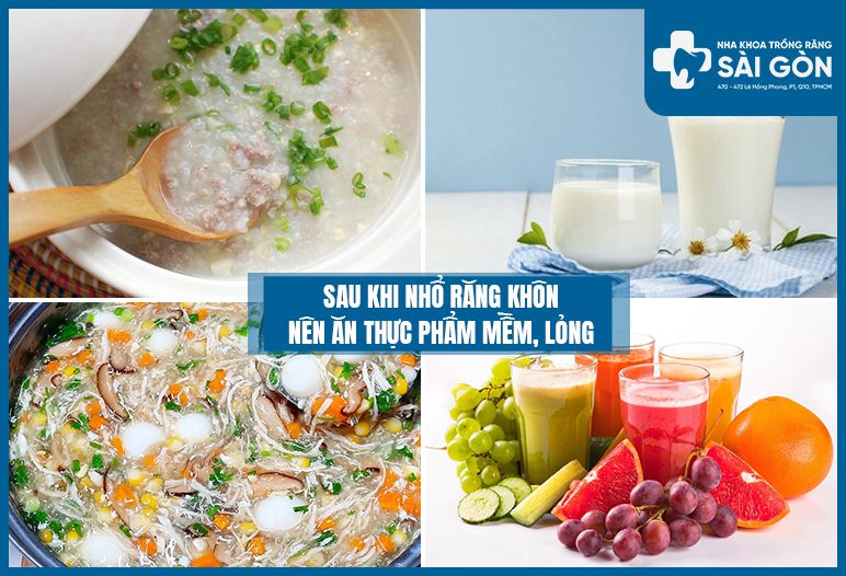 sau khi nhổ răng khôn nên ăn gì