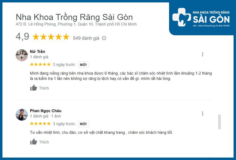 review nha khoa niềng răng