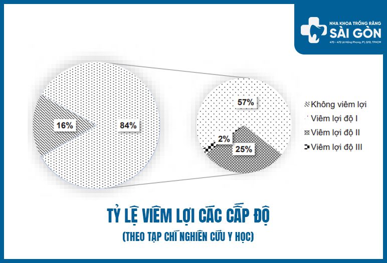 ty le viem nuou thống kê tỷ lệ viêm nướu chân răng