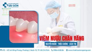 viêm nướu chân răng