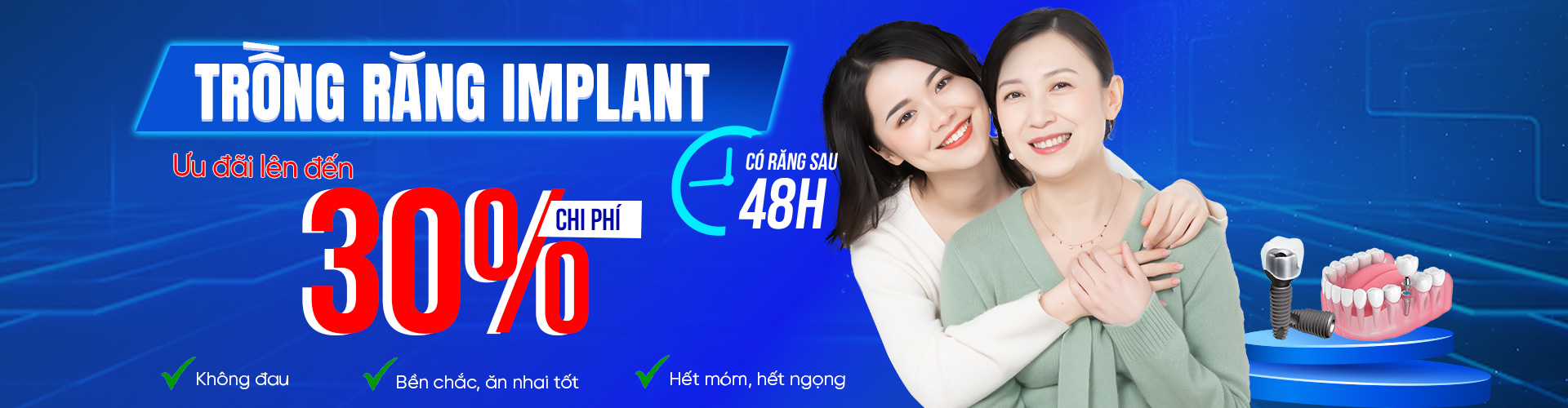 trong rang implant banner pc