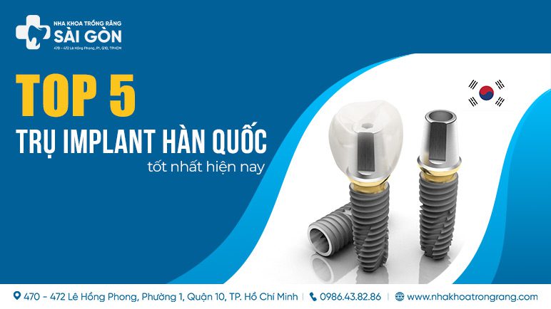 tru implant han quoc 1 TOP 5 Trụ Implant Hàn Quốc Tốt Nhất TP.HCM Hiện Nay