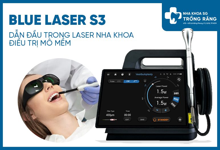 blue laser s3