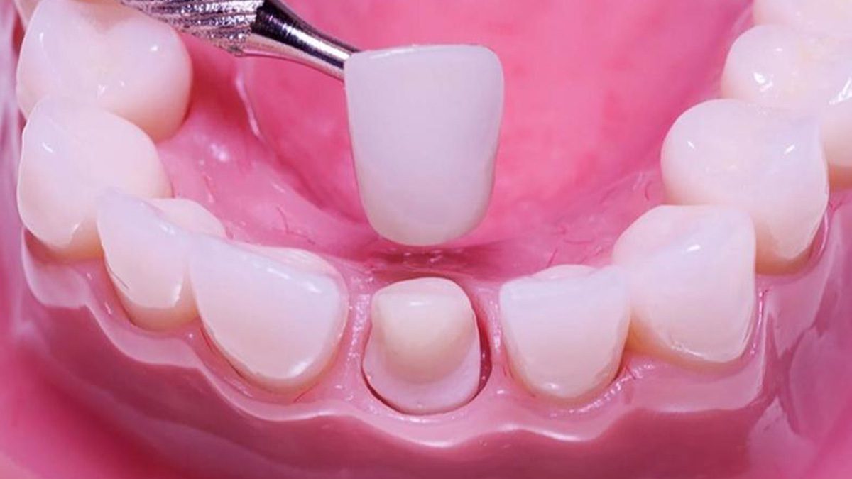 gan tam rang su gan tam rang su