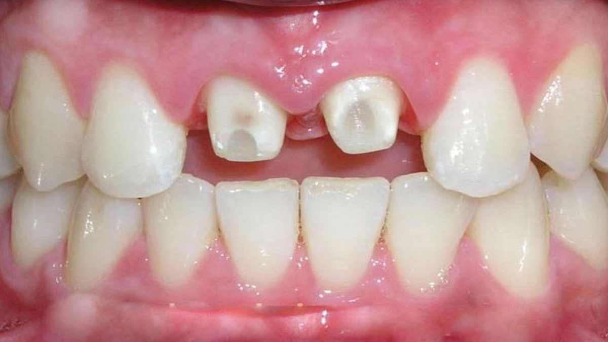 gay te mai cui rang gay te mai cui rang