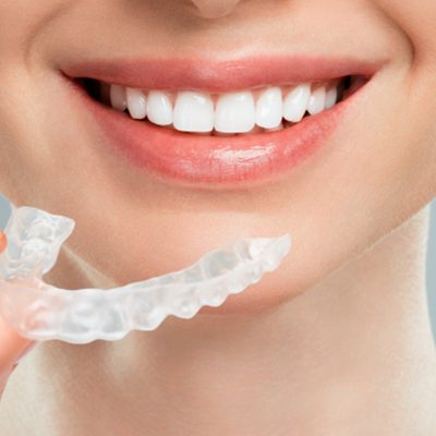 nieng rang invisalign