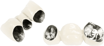 rang su kim loai rang su kim loai