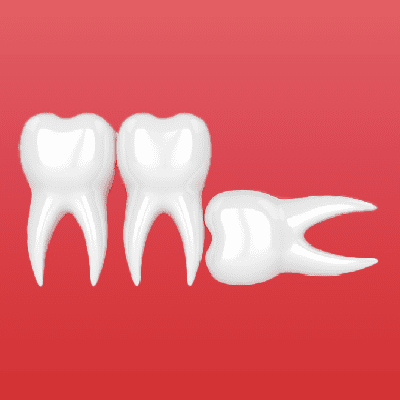 truong hop chi dinh nho rang khon 4 truong hop chi dinh nho rang khon 4