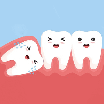 truong hop chi dinh nho rang khon truong hop chi dinh nho rang khon