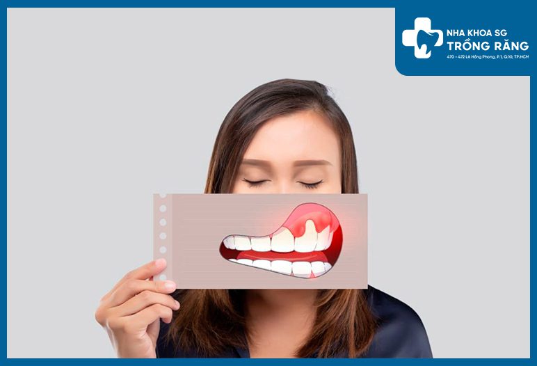 uu diem trong viec dieu tri u hat mieng granulomas bang laser 1