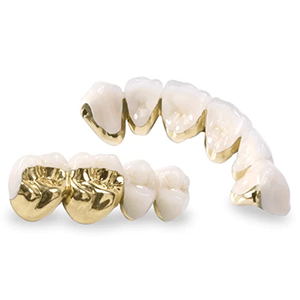 rang su kim loai quy