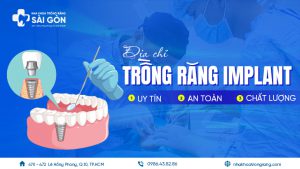 trồng răng implant tphcm