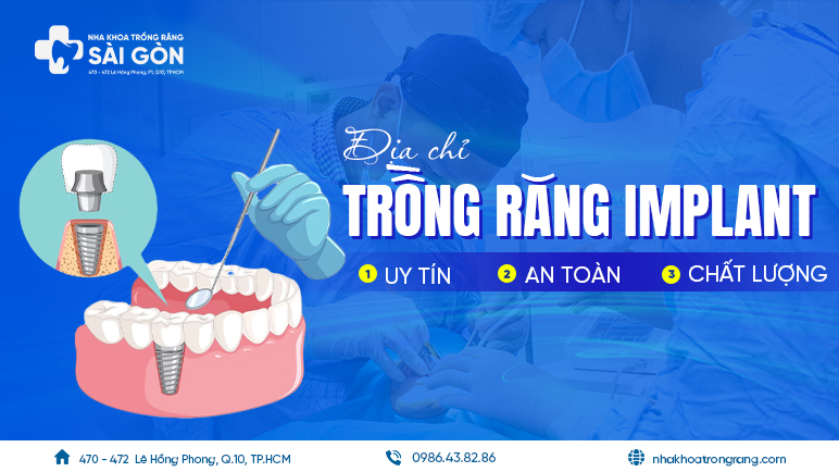 trồng răng implant tphcm