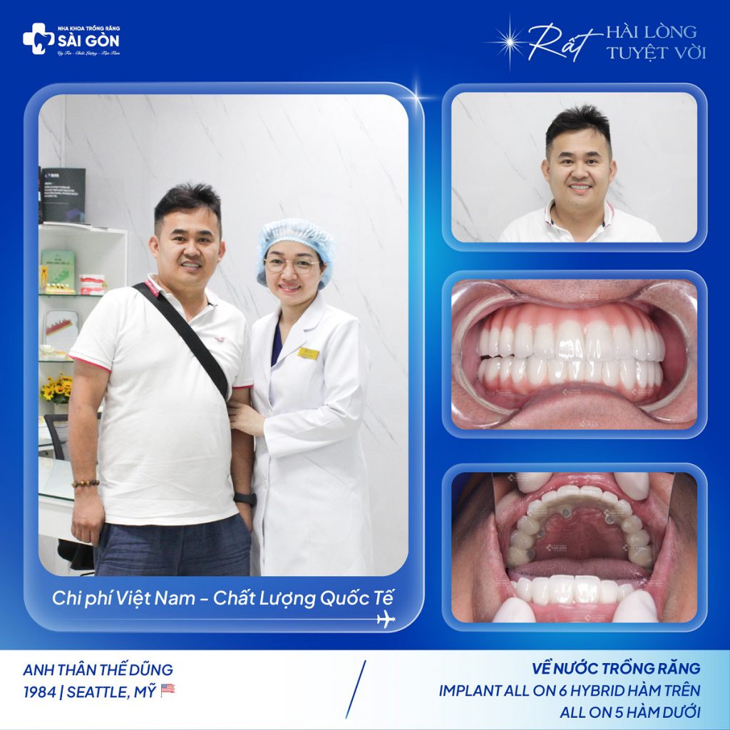 Anh Thân Thế Dũng (1984) từ Seattle, Mỹ về nước trồng răng implant toàn hàm