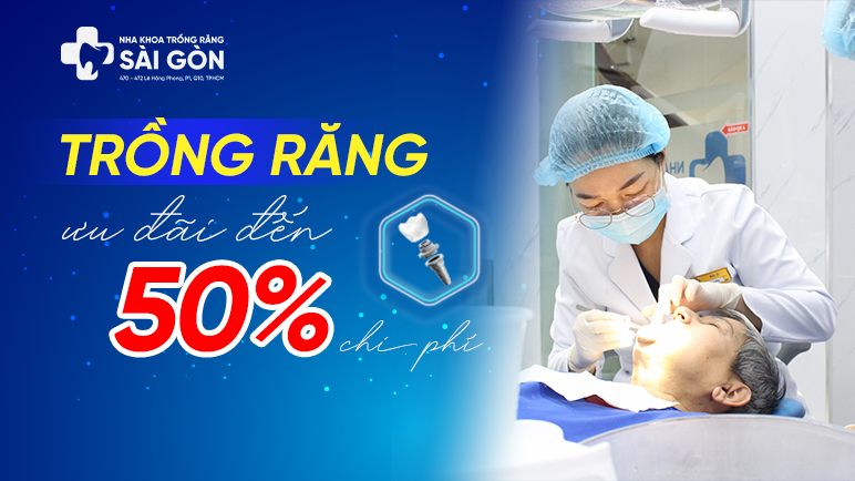 ưu đãi trồng răng