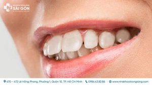 con gai rang ho co xau khong giai dap thac mac cho ban thumb