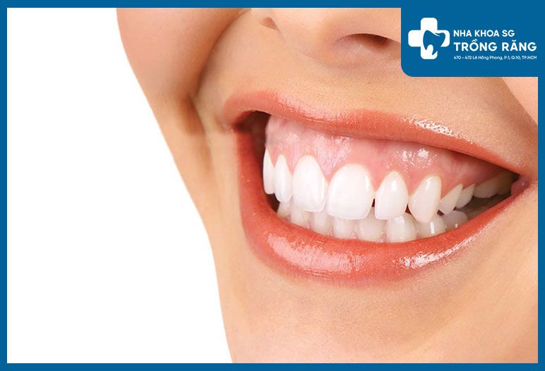 Cười nhe răng thể hiện tính cách gì?