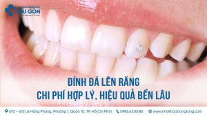 dinh da vao rang la gi compressed