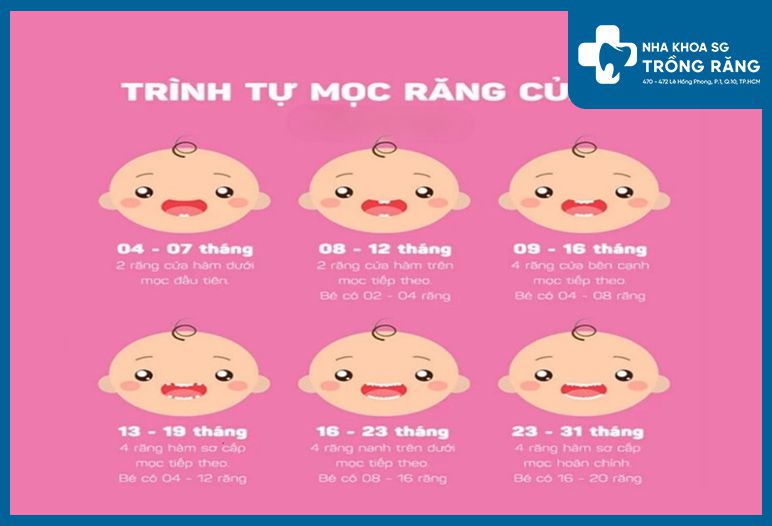 hinh anh loi tre moc rang cua 1 4
