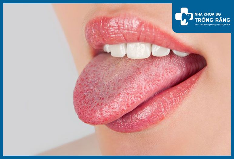 hinh anh luoi bi benh 1