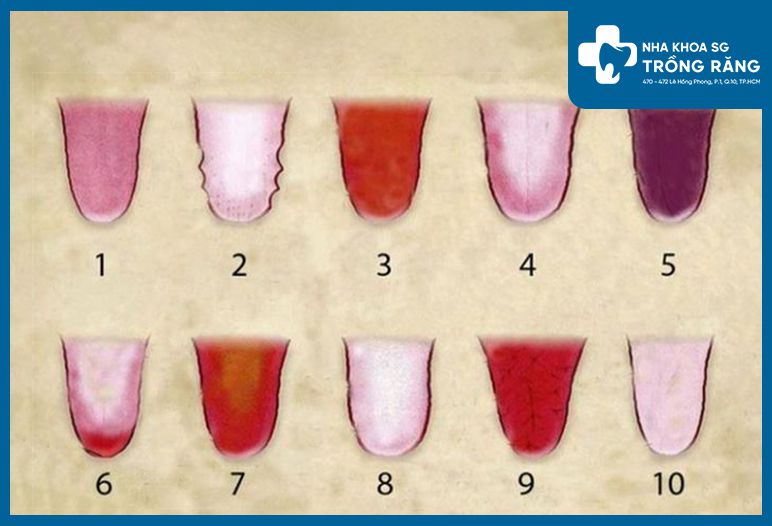 hinh anh luoi bi benh 2