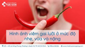 hinh anh viem gai luoi thumb compressed