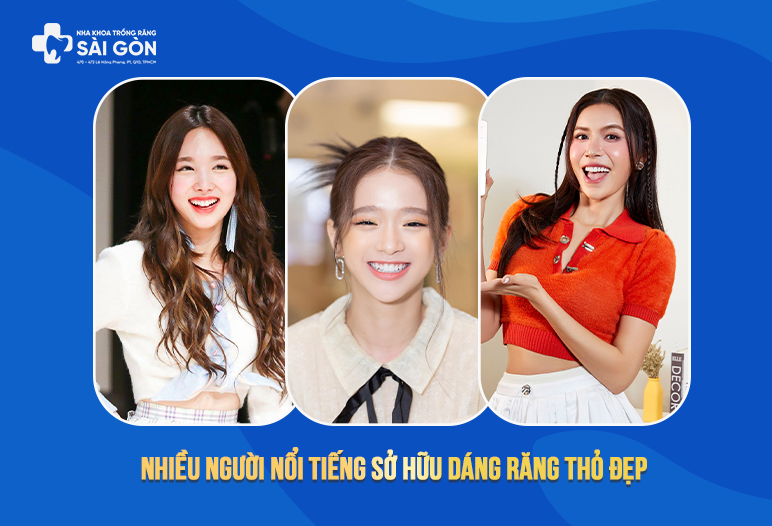 dáng răng thỏ đẹp