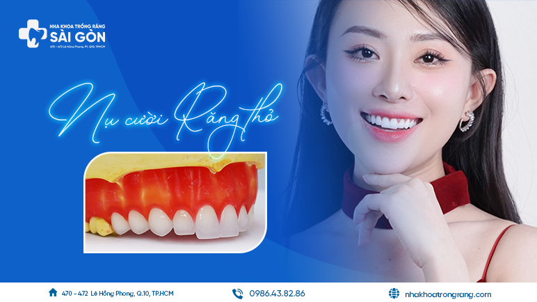 nụ cười răng thỏ