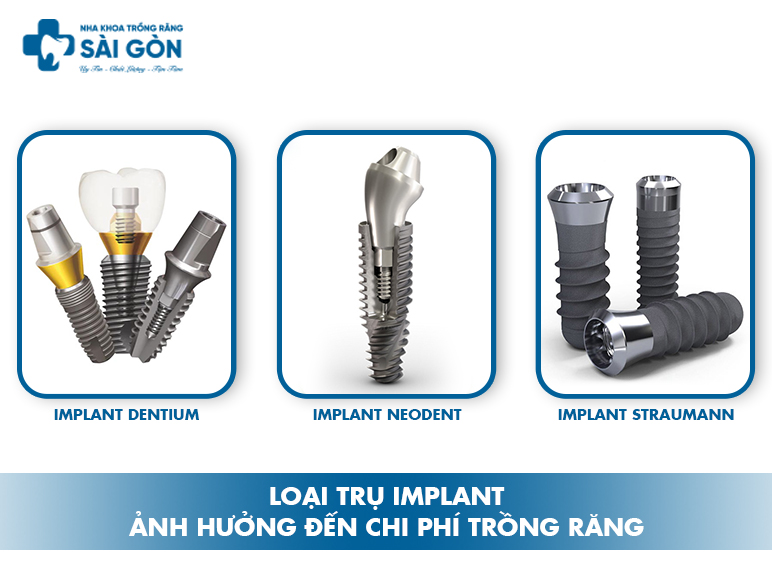 loại trụ implant ảnh hưởng đến chi phí trồng răng hàm