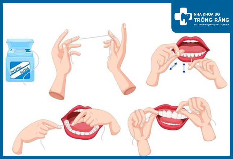 Cách sử dụng chỉ nha khoa đúng cách