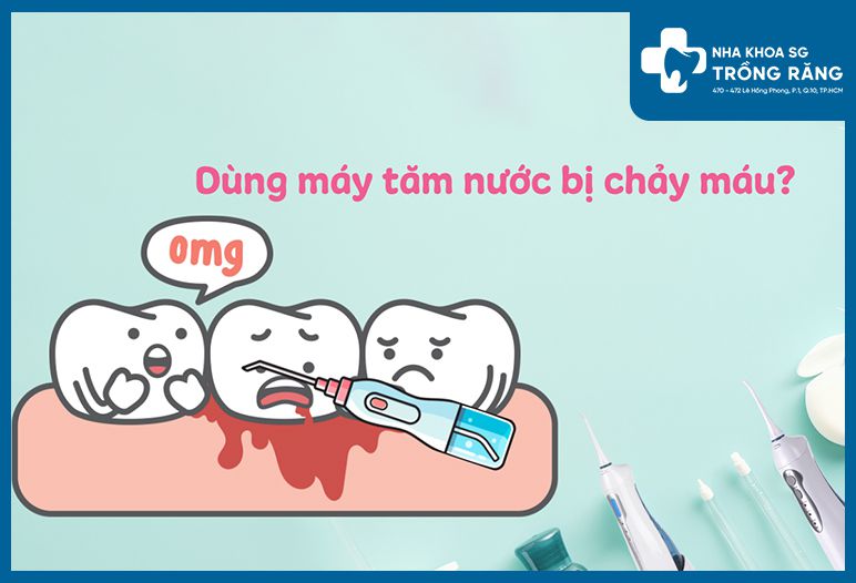 chi nha khoa 4 compressed