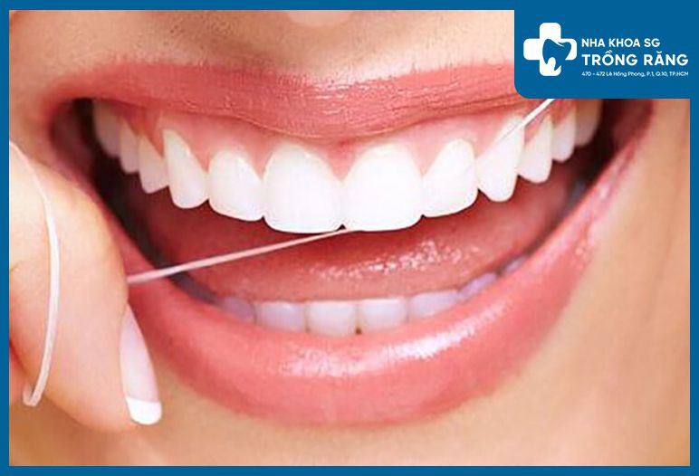 Tổng quan về chỉ nha khoa - Chìa khóa cho một nụ cười rạng rỡ