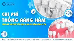 chi phí trồng răng hàm