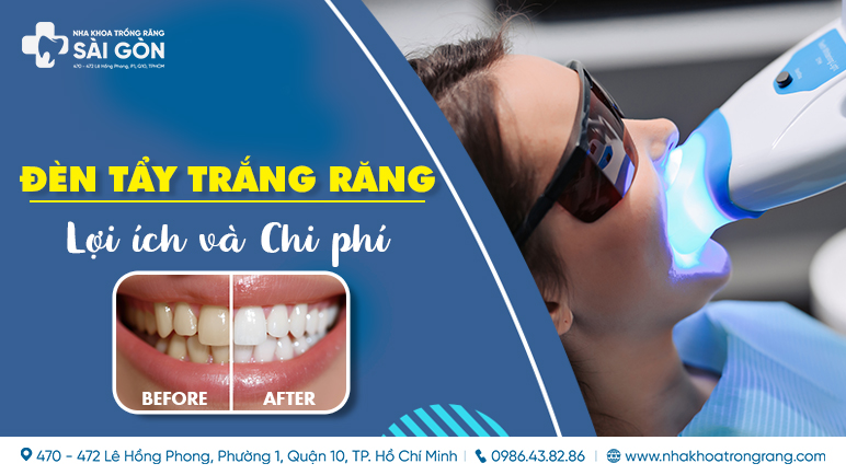 đèn tẩy trắng răng là gì