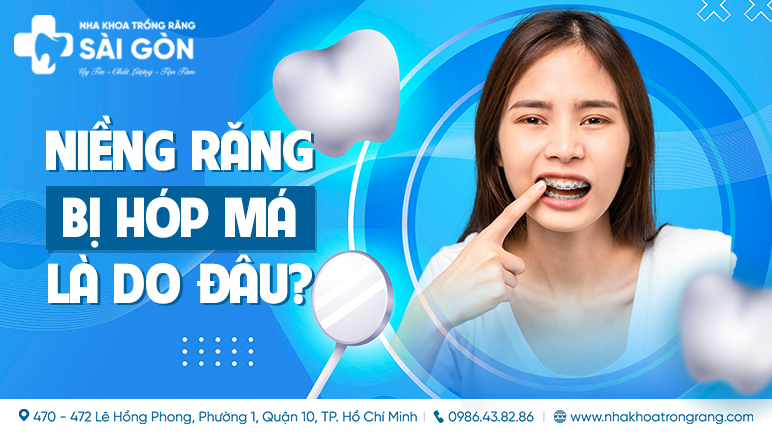 niềng răng bị hóp má