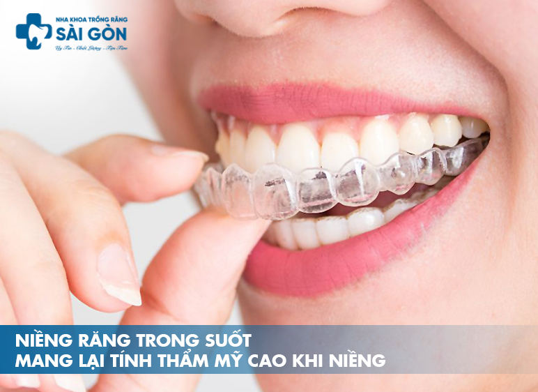 niềng răng trong suốt