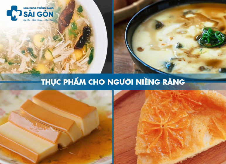 thực phẩm khi niềng răng