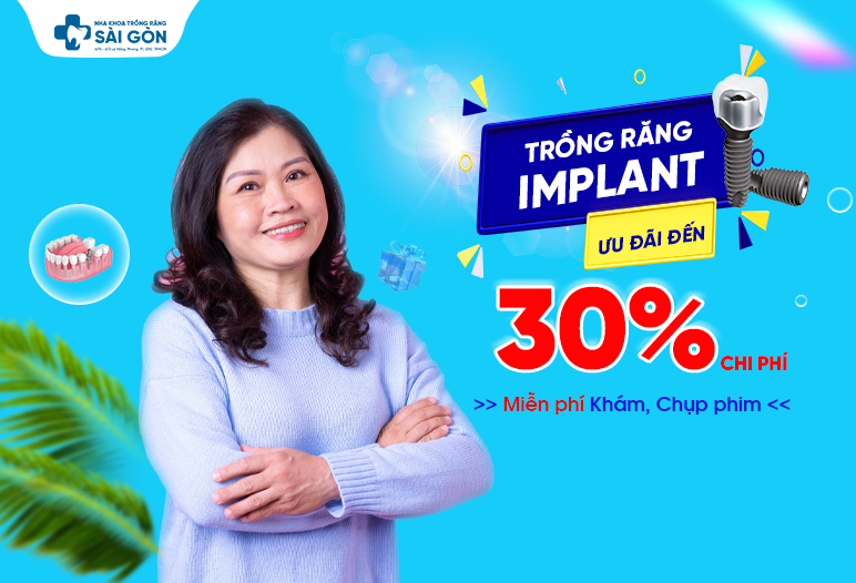 ưu đãi trồng răng