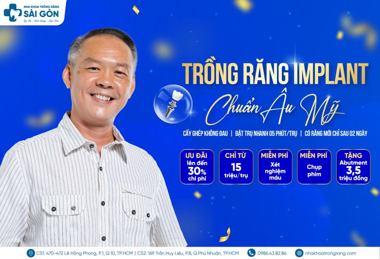 772x526 trong rang 01 compressed