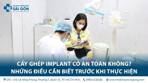 Cay ghep implant an toan 1