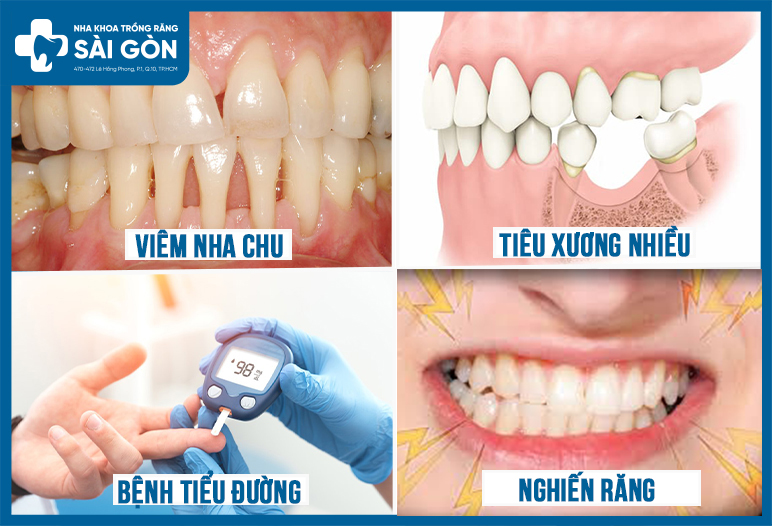 cac truong hop khong nen nieng rang