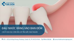 dau nhuc rang vao ban dem